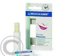 Medical Care Pomáda placenta 4.8 g