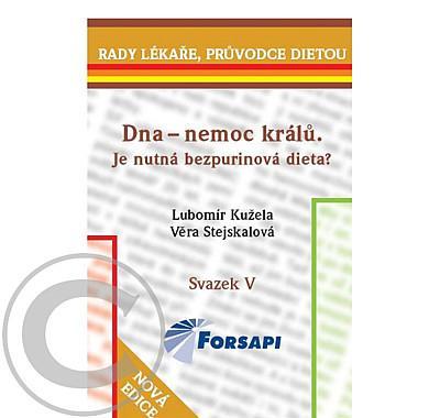 Dna - nemoc králů. Je nutná bezpurinová dieta?, Dna, nemoc, králů., Je, nutná, bezpurinová, dieta?